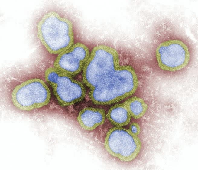Your Guide to Mold in Your Home